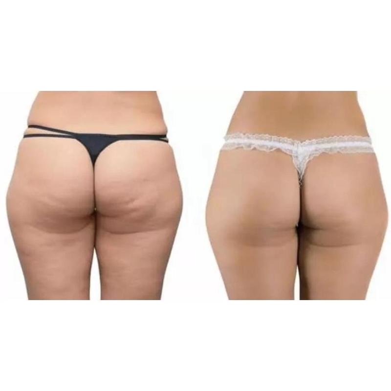 Tratamientos de estetica - 4